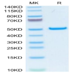 Human PLA2G1B Protein (PLA-HM21B)