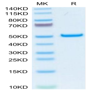 Human PLA2G1B Protein (PLA-HM21B)