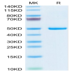 Mouse PLA2G1B Protein (PLA-MM21B)