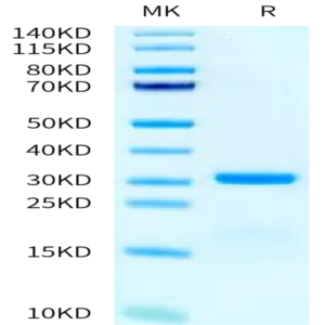 Rat PLAU/uPA Protein (PLA-RM101)