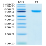 Human PLD4 Protein (PLD-HM104)