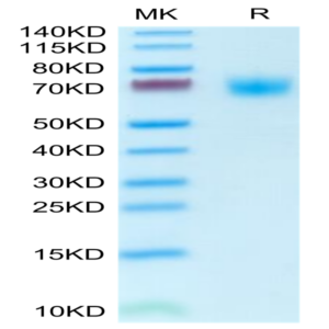 Mouse PLD4 Protein (PLD-MM104)
