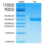 Cynomolgus PRLR Protein (PLR-CM101)