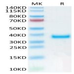 Human PRLR Protein (PLR-HM101)