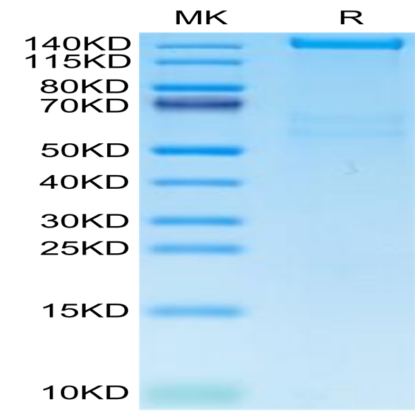 Human PLXNA1 Protein (PLX-HM101)