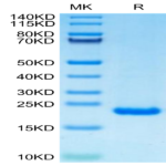 Human PRL-2/PTP4A2 Protein (PRL-HE102)