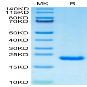 Human PRL-2/PTP4A2 Protein (PRL-HE102)