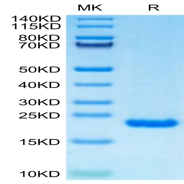 Human PRL-2/PTP4A2 Protein (PRL-HE102)