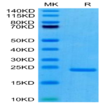 Human PRL-3/PTP4A3 Protein (PRL-HE103)