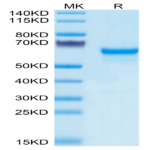 Human PRNP Protein (PRP-HM201)