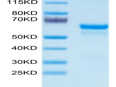 Mouse PRNP Protein (PRP-MM201)