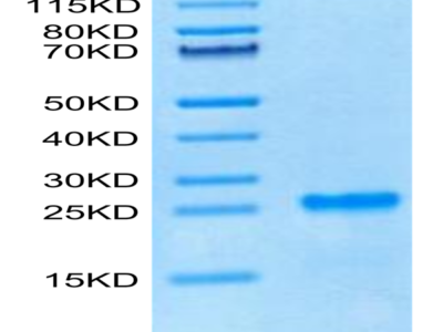 Cynomolgus PS20 Protein (PS2-CE120)