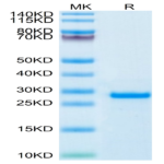 Human PS20 Protein (PS2-HE120)
