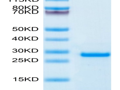 Human PS20 Protein (PS2-HE120)