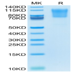 Human PSGL-1 Protein (PSG-HM162)