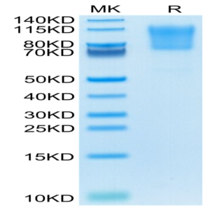 Human PSGL-1 Protein (PSG-HM162)
