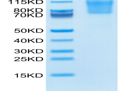 Human PSGL-1 Protein (PSG-HM162)