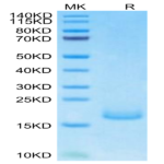 Human PSMP Protein (PSM-HM101)