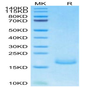 Human PSMP Protein (PSM-HM101)