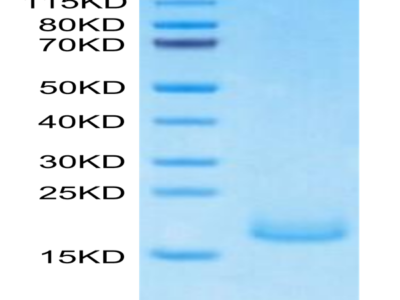 Human PSMP Protein (PSM-HM101)