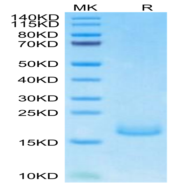 Human PSMP Protein (PSM-HM101) Human PSMP Protein (PSM-HM101)