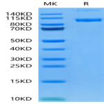 Human PSMA/FOLH1 Protein (PSM-HM110)