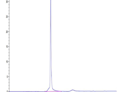 Human PSMP Protein (PSM-HM201)