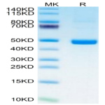 Human PSMP Protein (PSM-HM201)