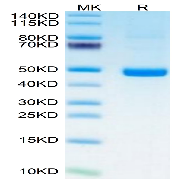 Human PSMP Protein (PSM-HM201)