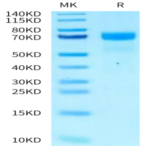 Mouse PSAP/Prosaposin Protein (PSP-MM001)