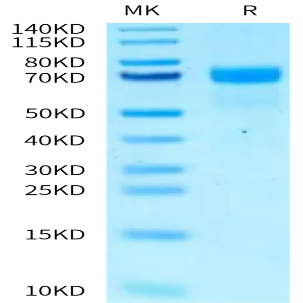 Mouse PSAP/Prosaposin Protein (PSP-MM001) Mouse PSAP/Prosaposin Protein (PSP-MM001)