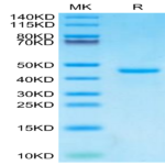Human PTH Protein (PTH-HM201)