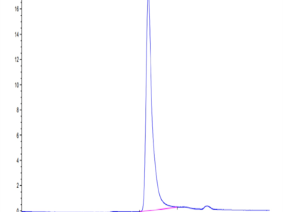 Mouse PTN Protein (PTN-MM201)