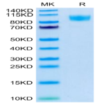 Human CD45/PTPRC Protein (PTP-HM404)