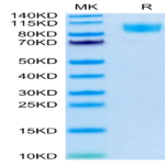 Biotinylated Human CD45/PTPRC Protein (PTP-HM404B)