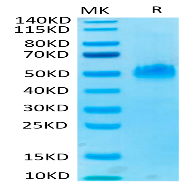 Human PVRIG Protein (PVR-HM301)