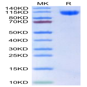 Human RET Protein (RET-HM101)