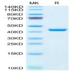 Human RETN Protein (RET-HM201)