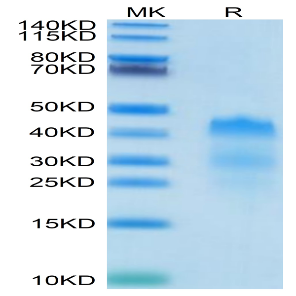 Human RGMa Protein (RGM-HM401)