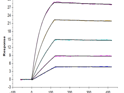 Human RANKL/TNFSF11/CD254 Protein (RKL-HM001)