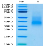Human RANKL/TNFSF11/CD254 Protein (RKL-HM001)