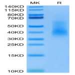 Human RANKL/TNFSF11/CD254 Protein (RKL-HM101)