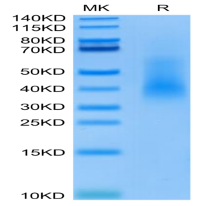 Human RANKL/TNFSF11/CD254 Protein (RKL-HM101)