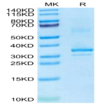 Mouse RANKL/TNFSF11/CD254 Protein (RKL-MM101)