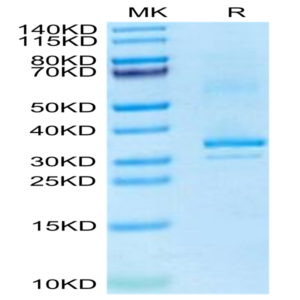 Mouse RANKL/TNFSF11/CD254 Protein (RKL-MM101)