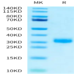 Human RNF43 Protein (RNF-HM143)