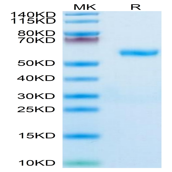 Human RNF43 Protein (RNF-HM234)