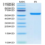 Mouse RNF43 Protein (RNF-MM234)