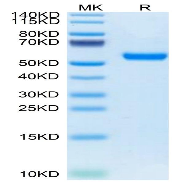 Mouse RNF43 Protein (RNF-MM234)