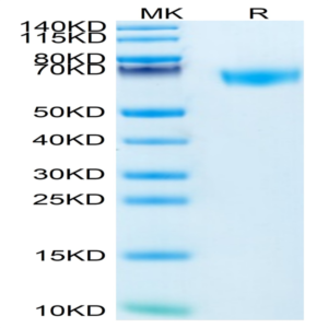 Mouse ROBO4 Protein (ROB-MM104)
